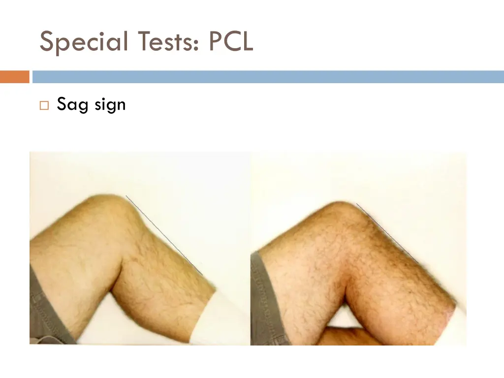 special tests pcl 2