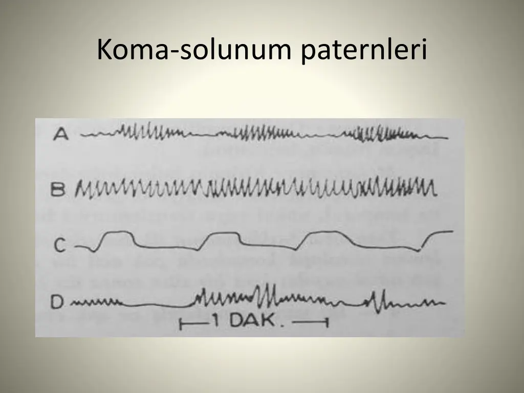 koma solunum paternleri