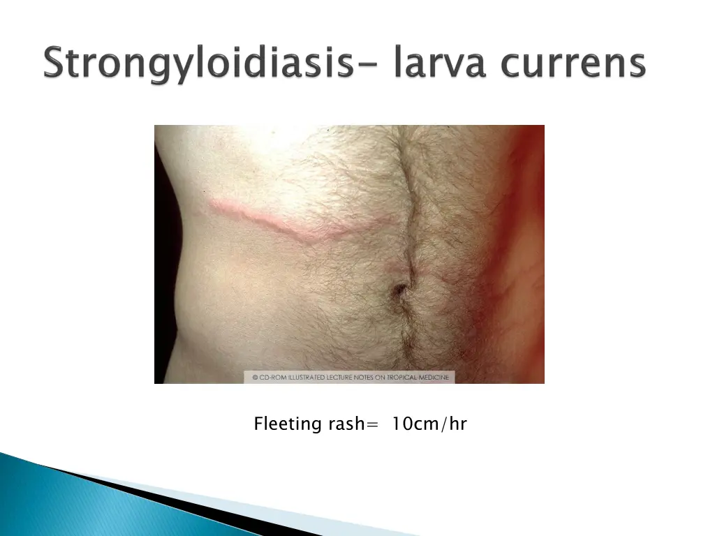 fleeting rash 10cm hr