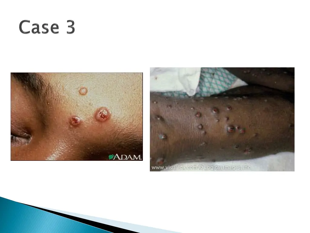 slide12