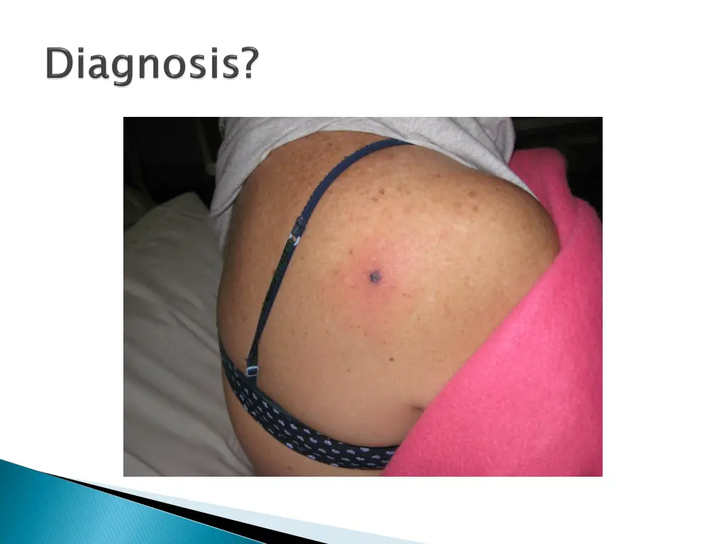slide30
