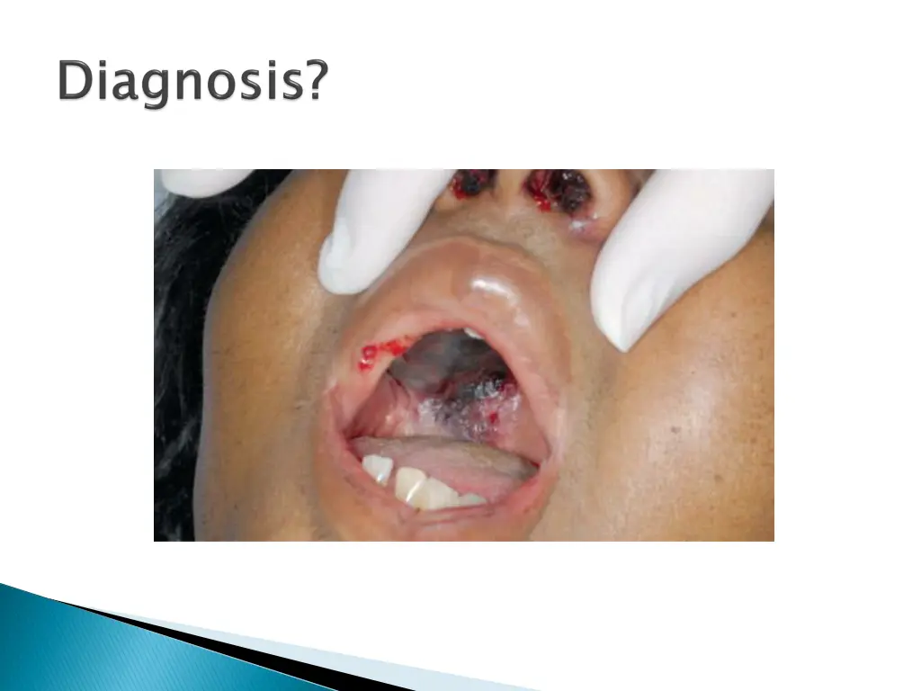 slide32