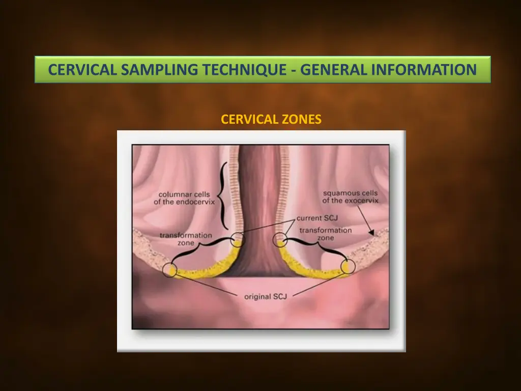cervical sampling technique general information 1