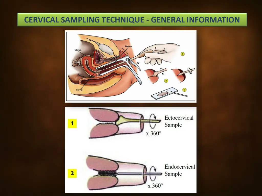 cervical sampling technique general information 3