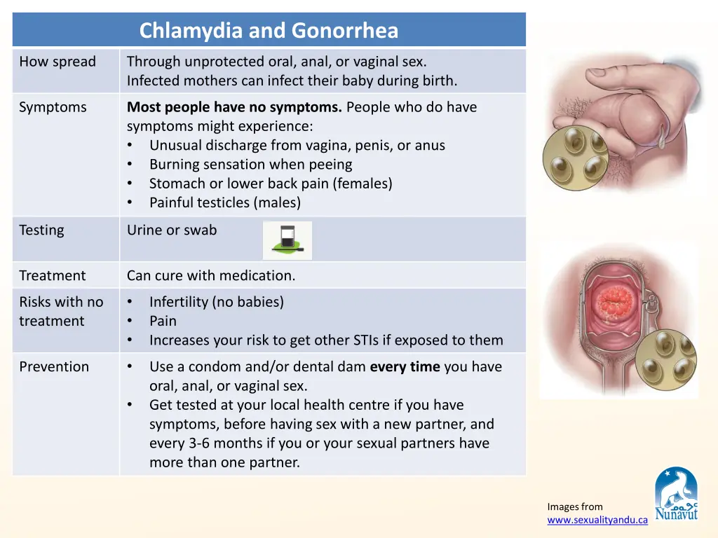chlamydia and gonorrhea