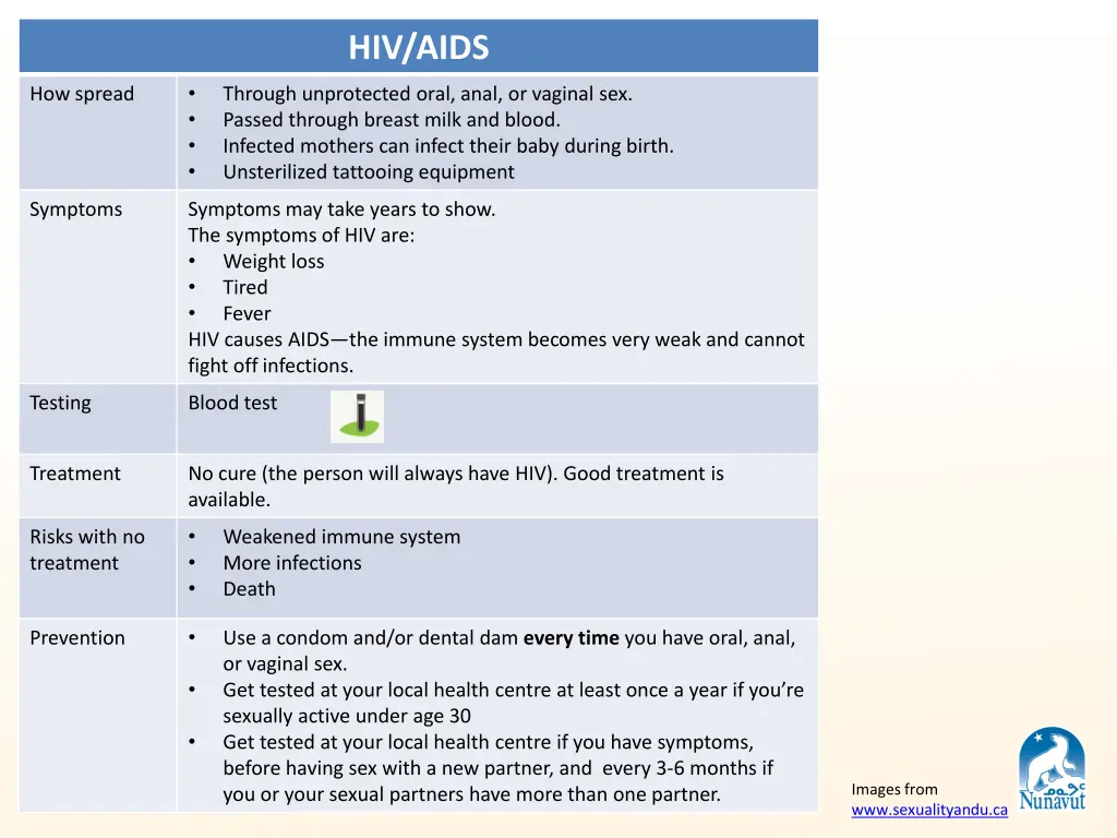 hiv aids