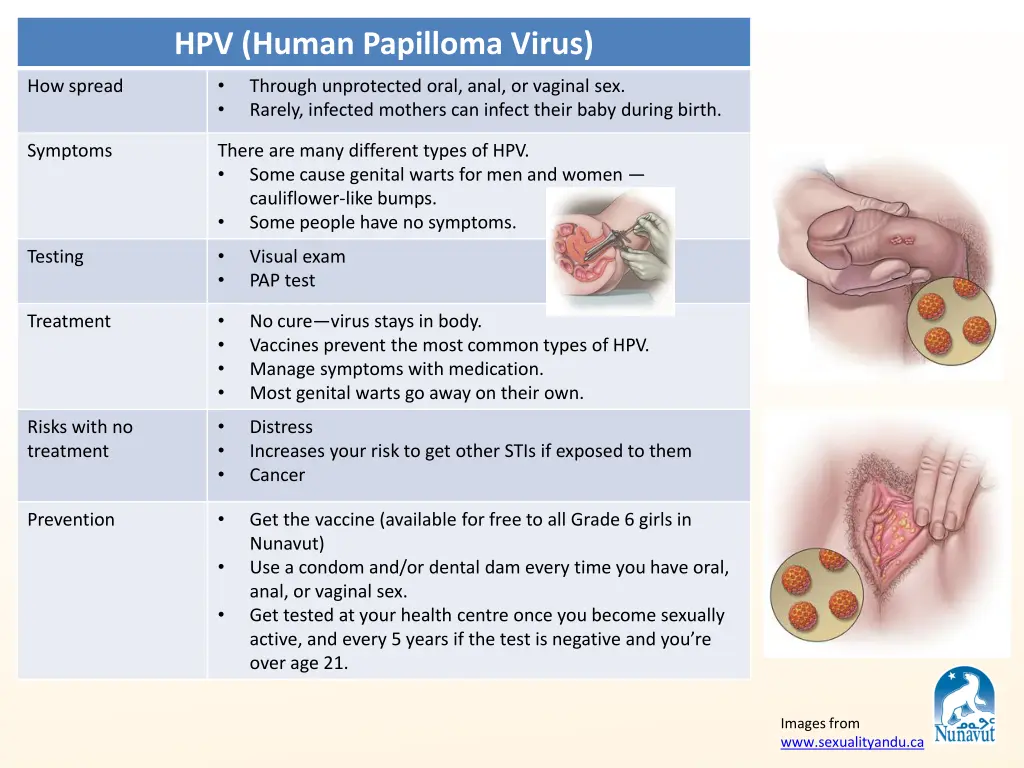 hpv human papilloma virus