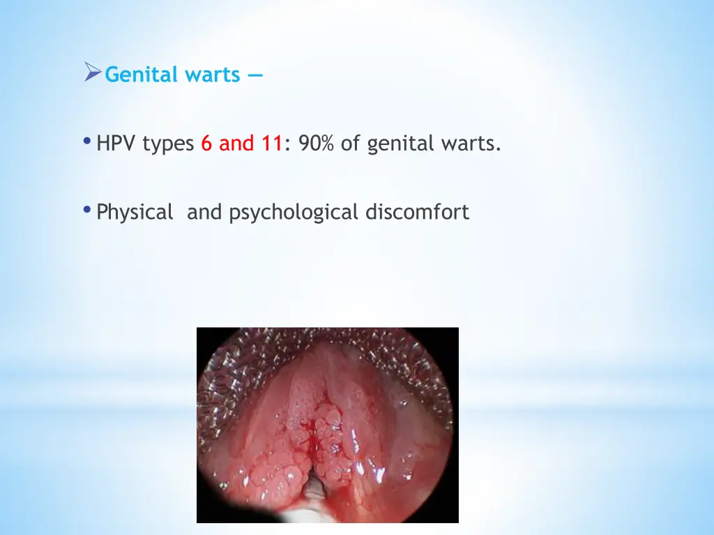 genital warts