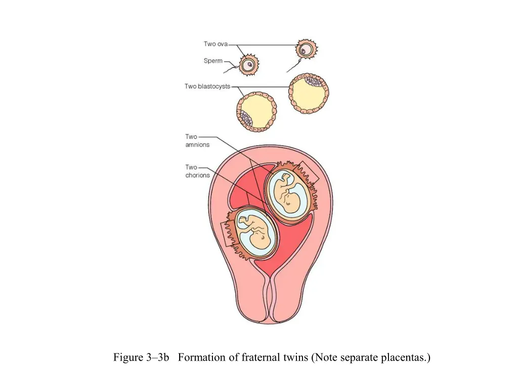 figure 3 3b formation of fraternal twins note