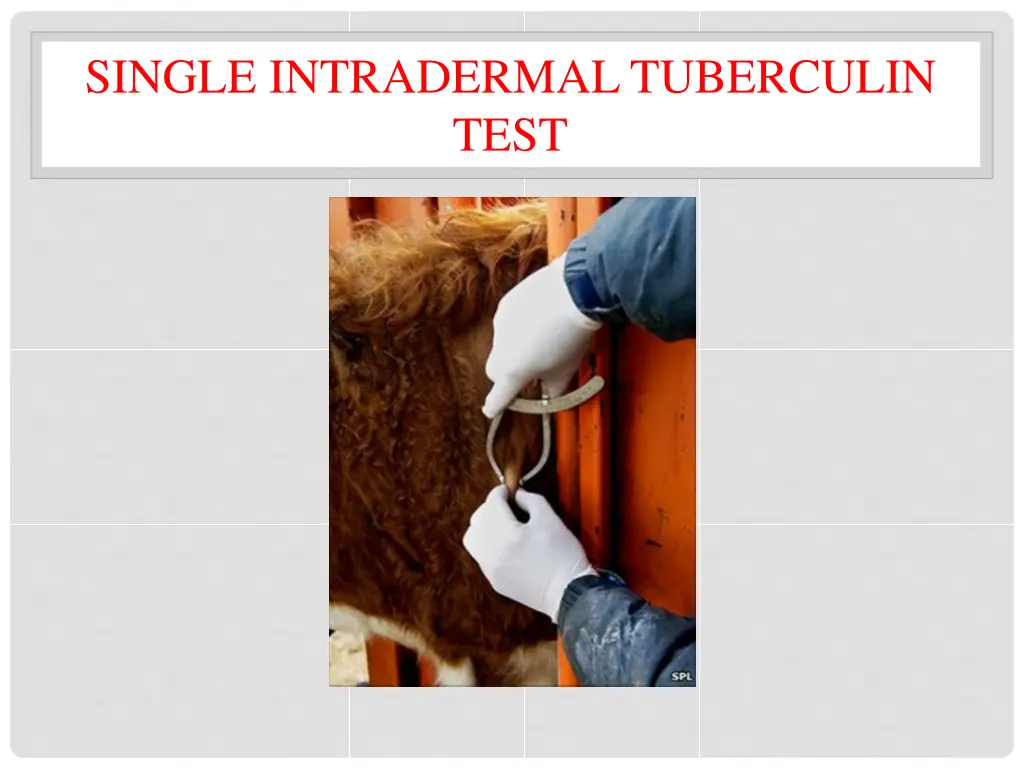 single intradermal tuberculin test 1