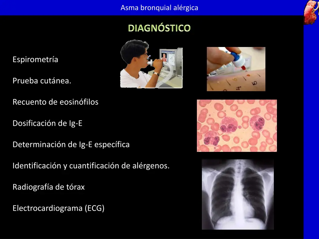 asma bronquial al rgica 10