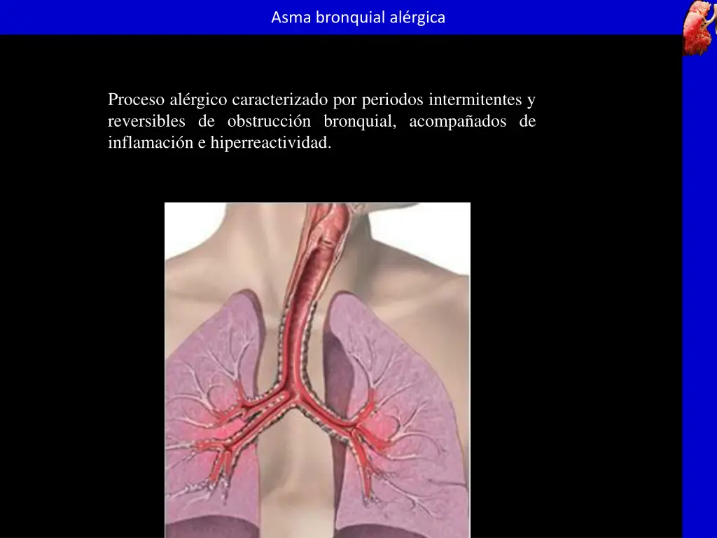 asma bronquial al rgica 2