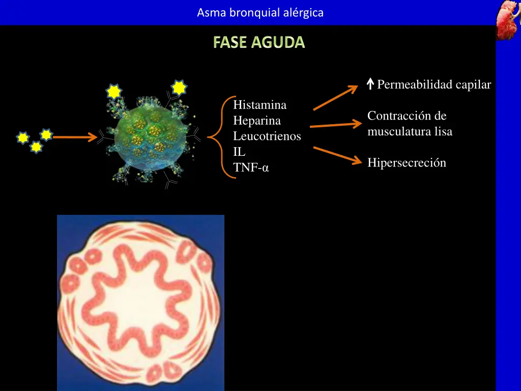 asma bronquial al rgica 6