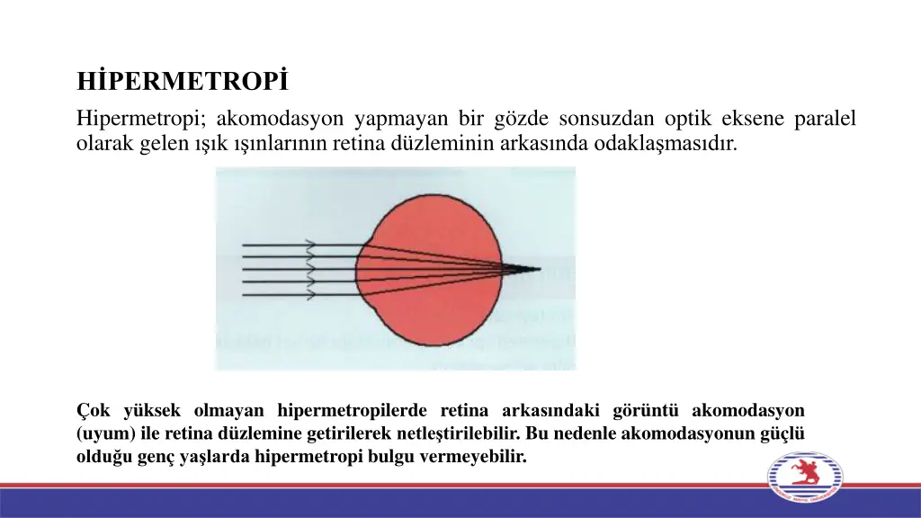h permetrop hipermetropi akomodasyon yapmayan 1