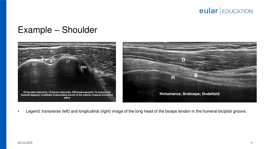 example shoulder
