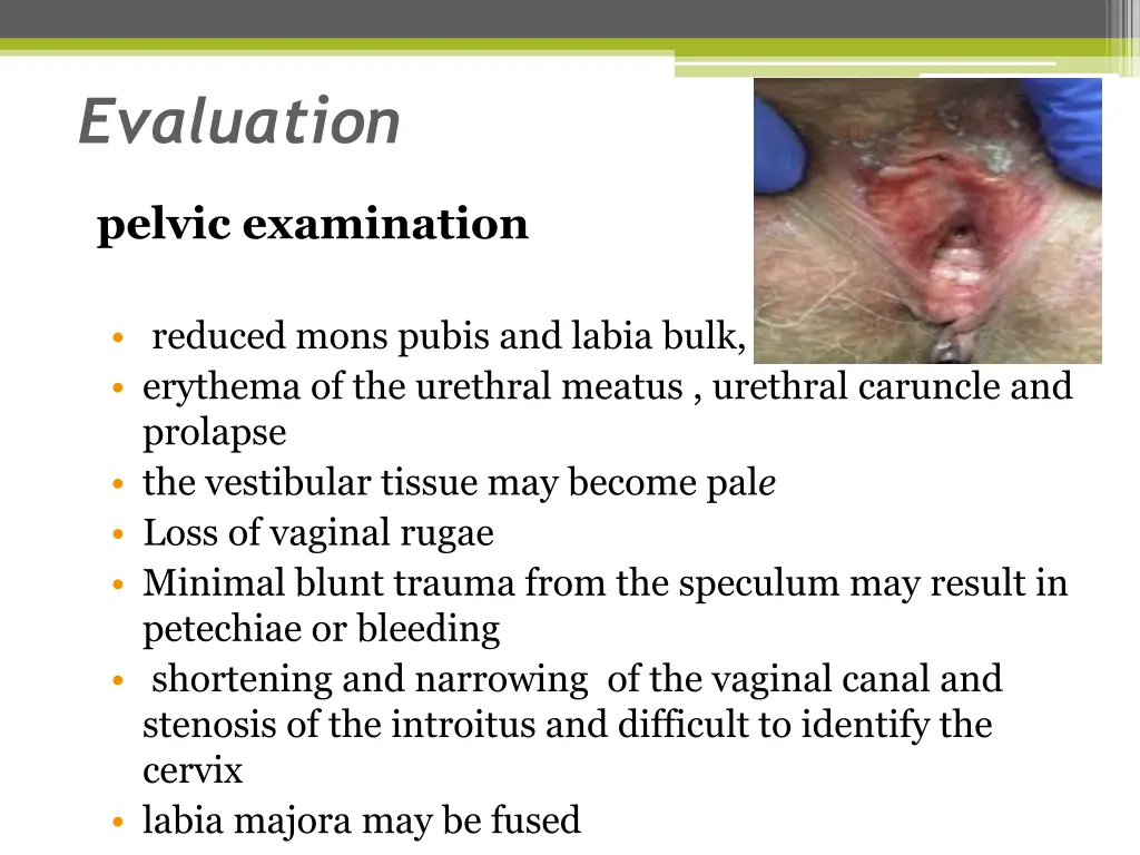 evaluation 1