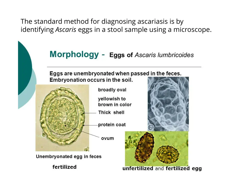 the standard method for diagnosing ascariasis