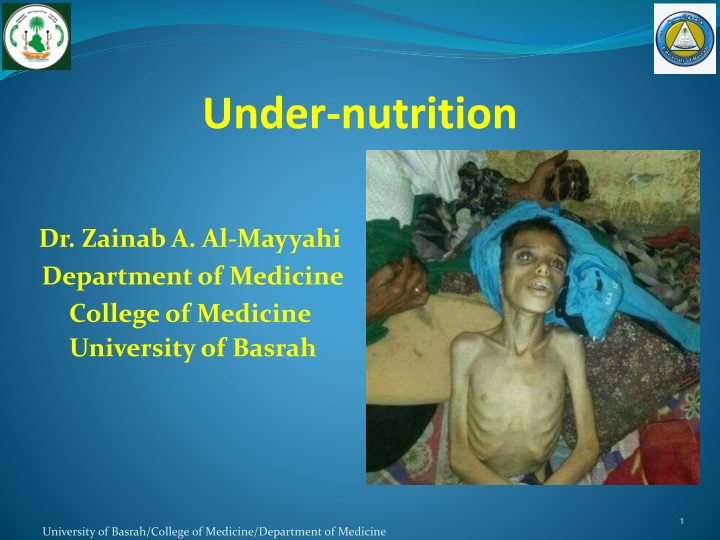 under nutrition
