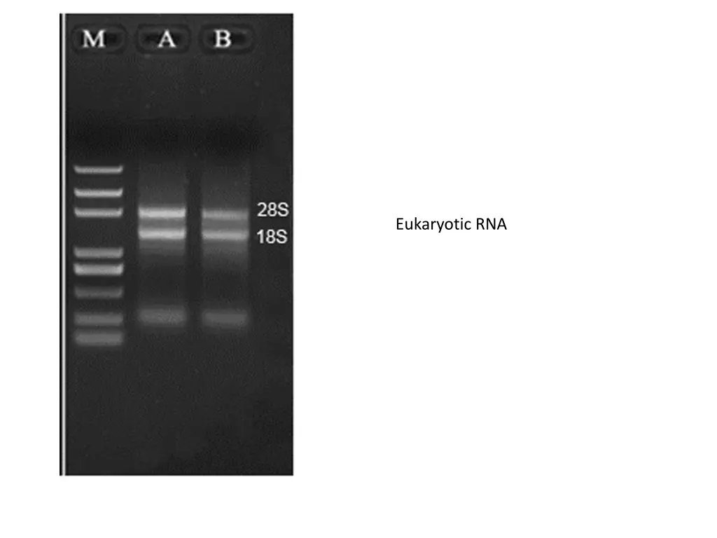 eukaryotic rna