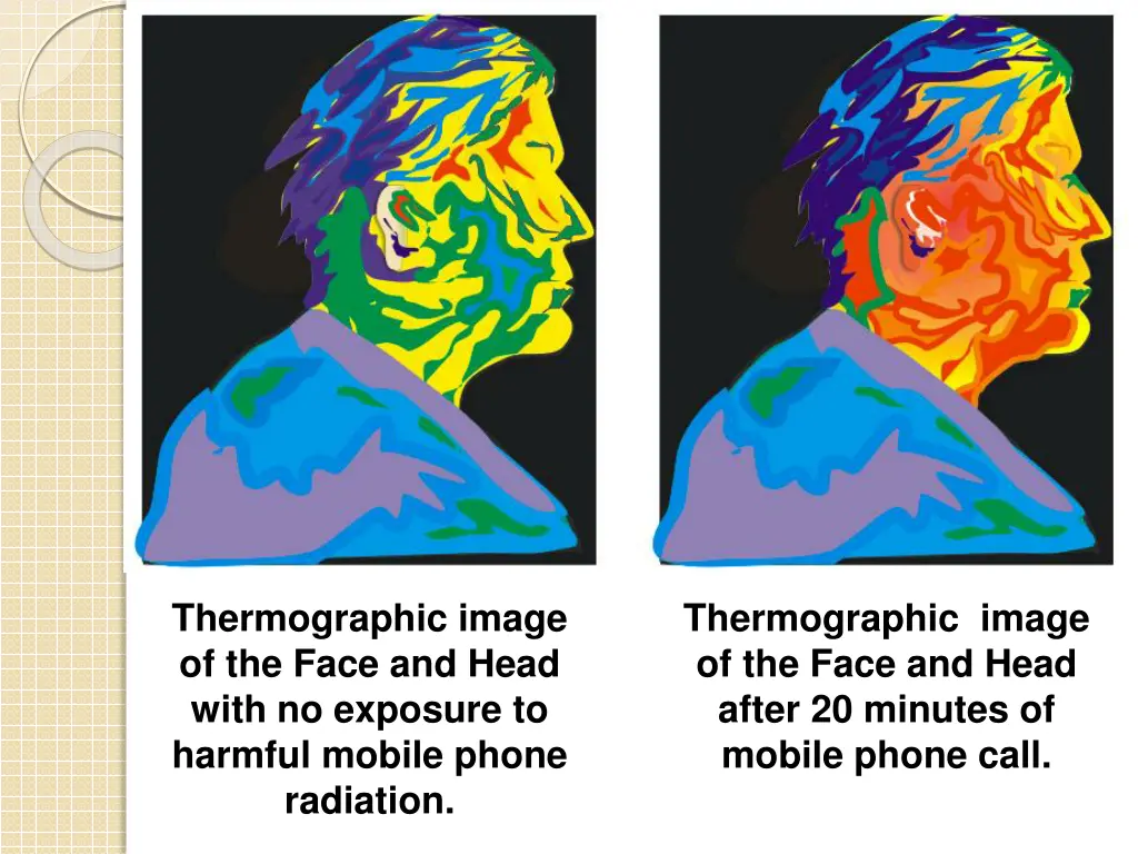 thermographic image of the face and head with