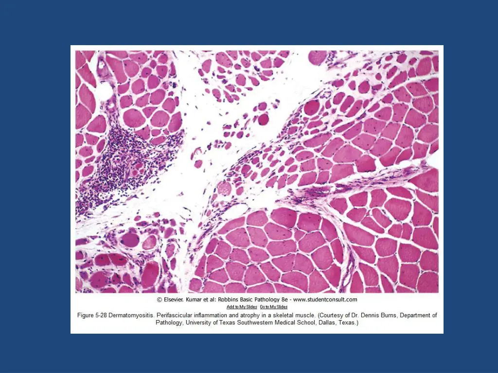 slide37