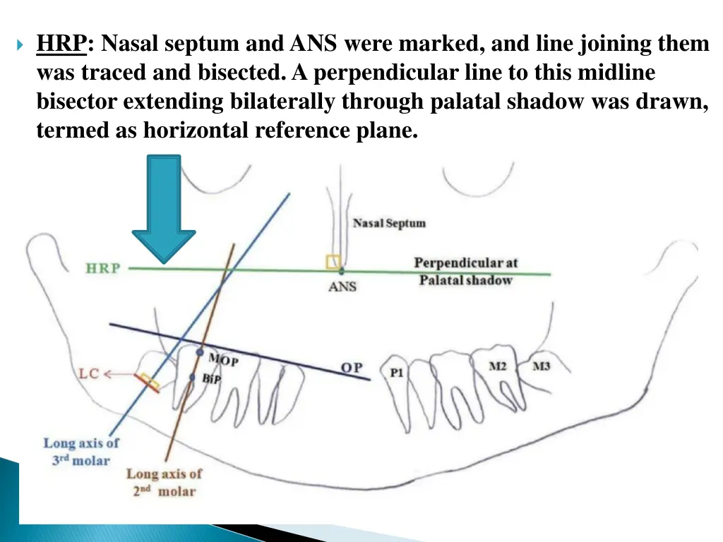 hrp nasal septum and ans were marked and line