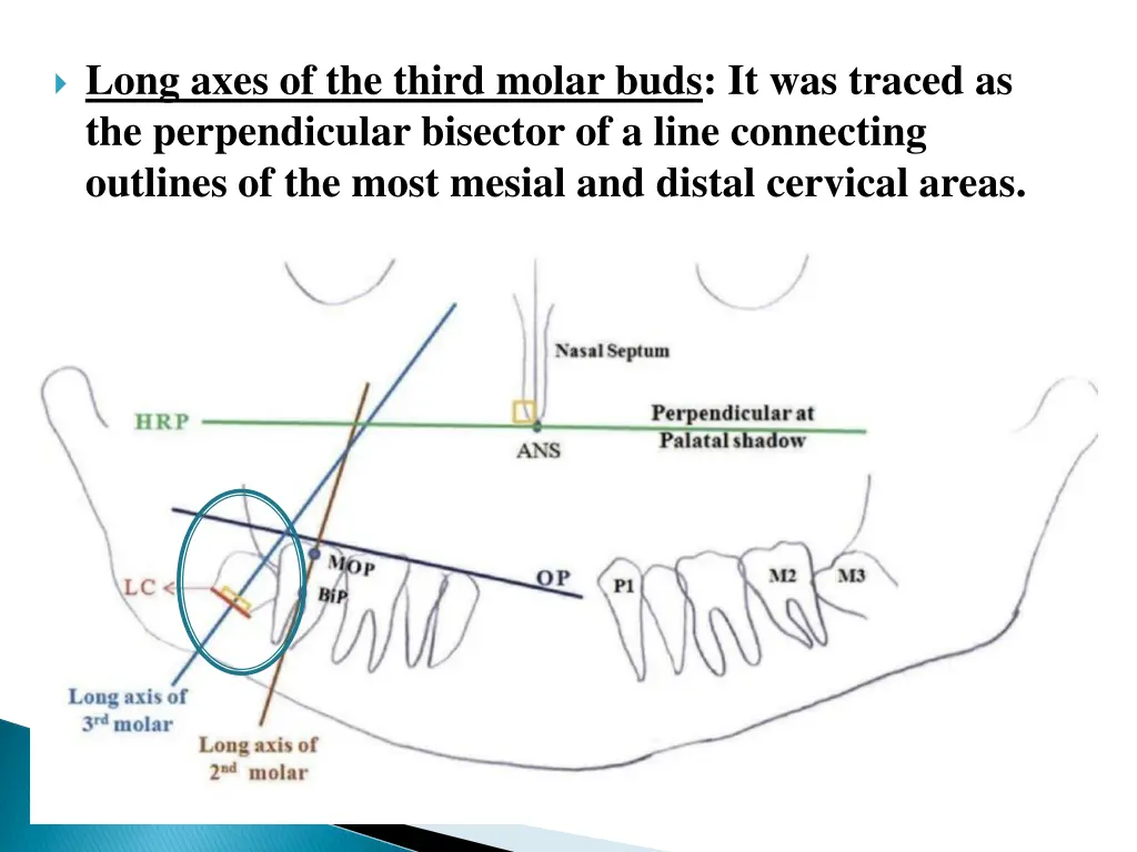 long axes of the third molar buds it was traced