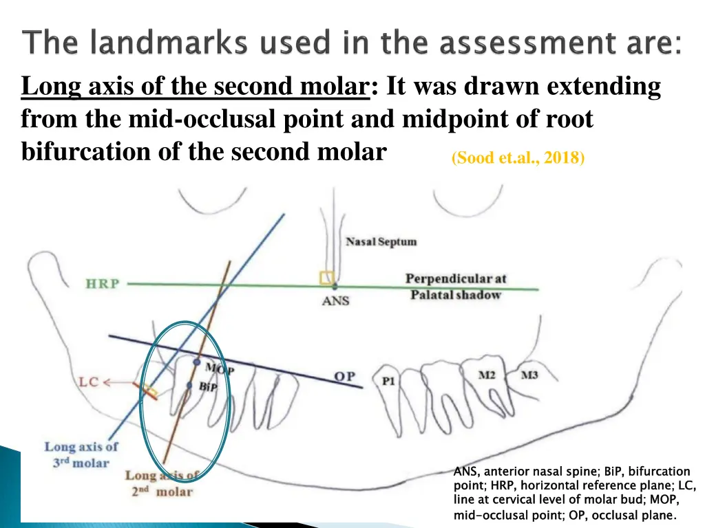 long axis of the second molar it was drawn