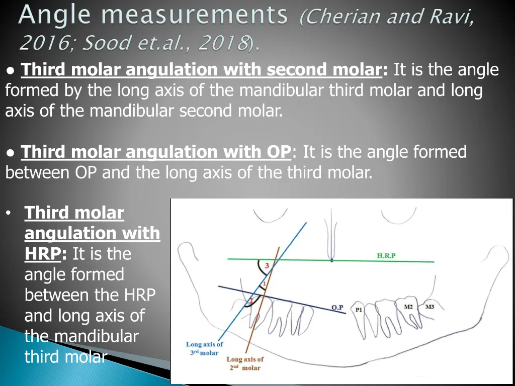third molar angulation with second molar