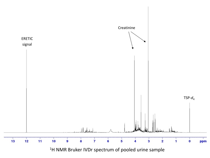 creatinine