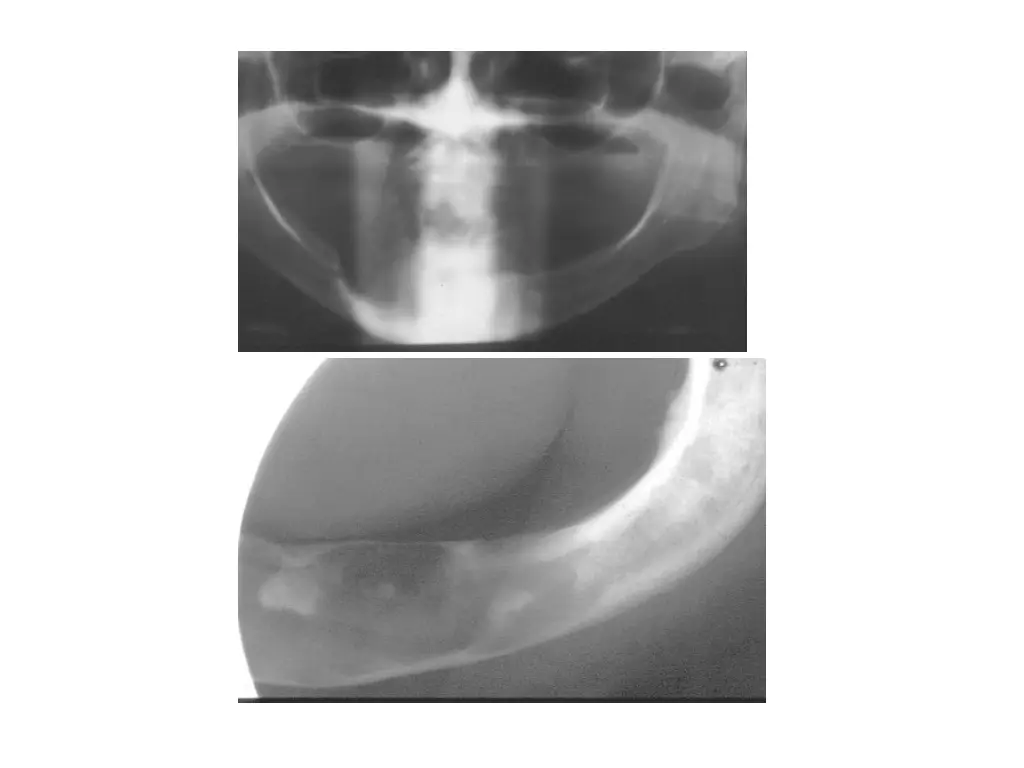slide13