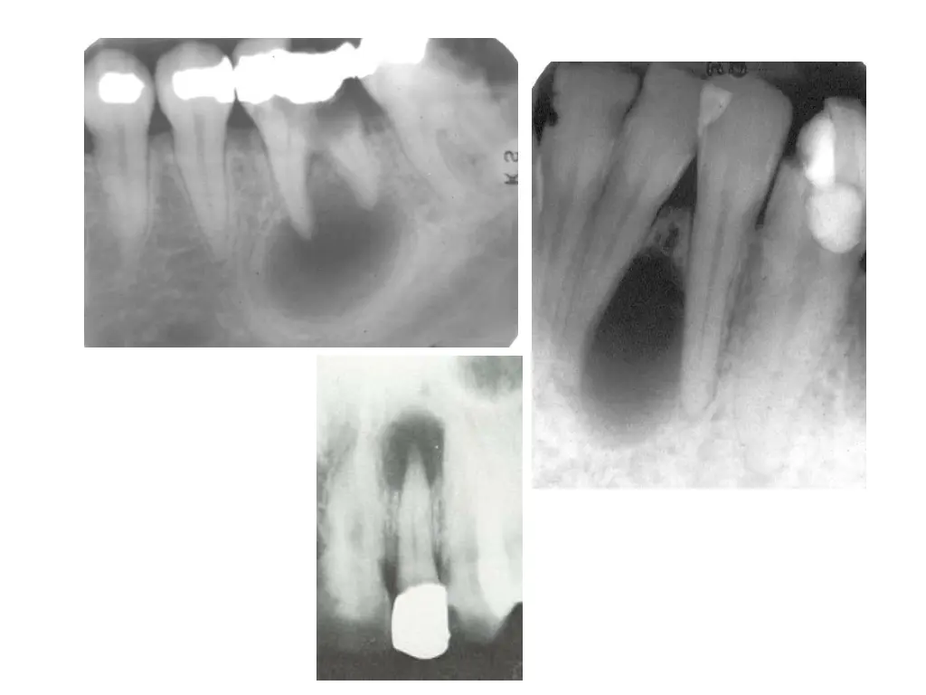 slide4