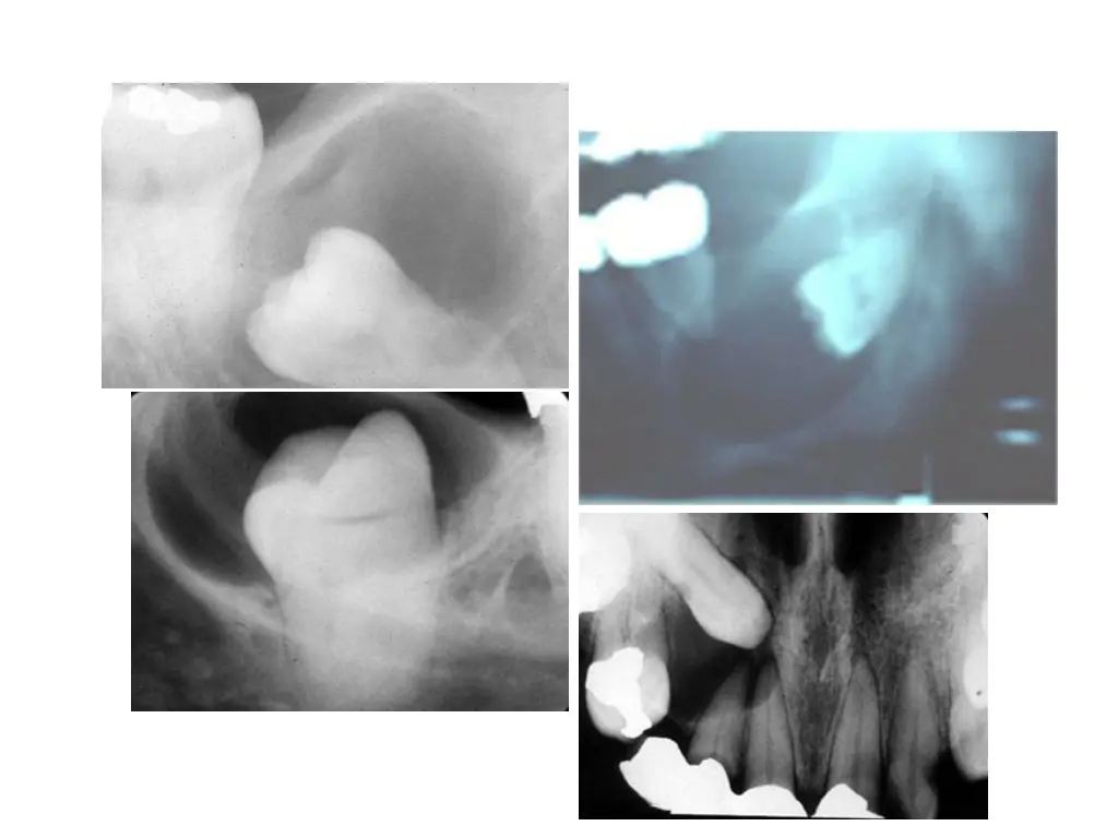 slide6