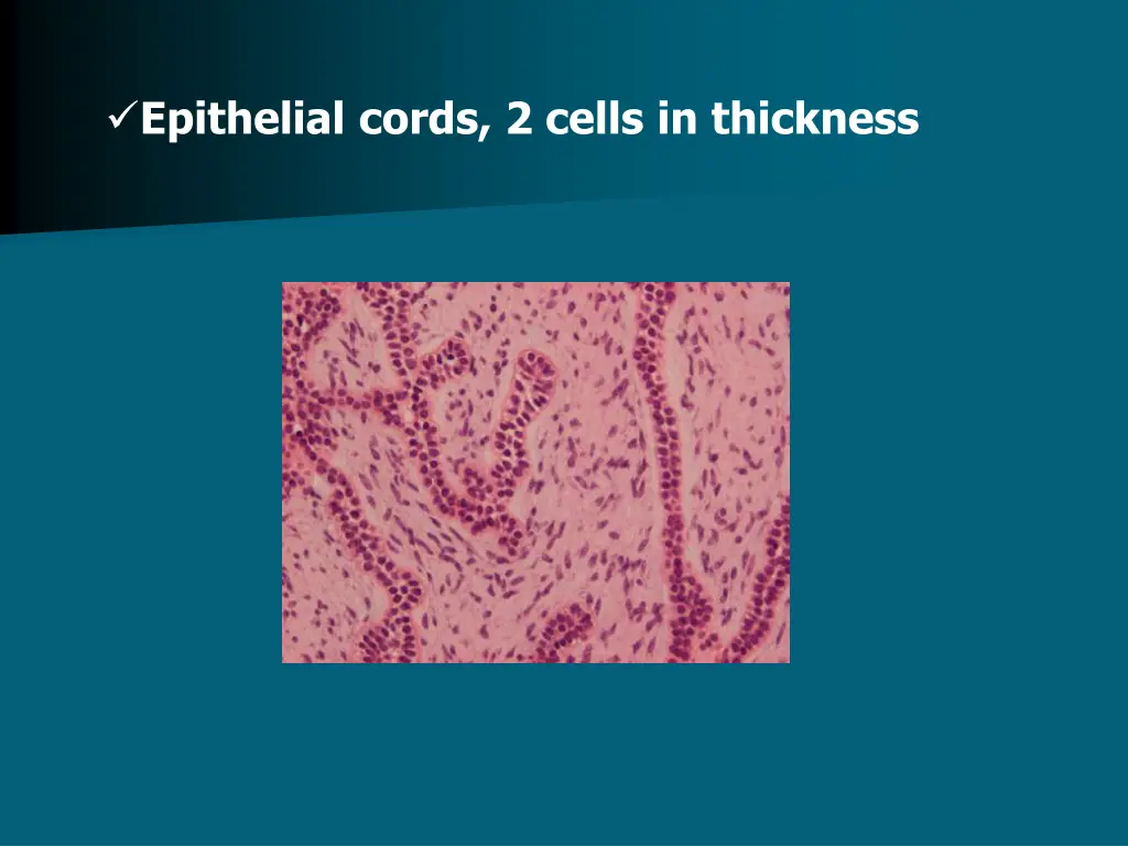 epithelial cords 2 cells in thickness