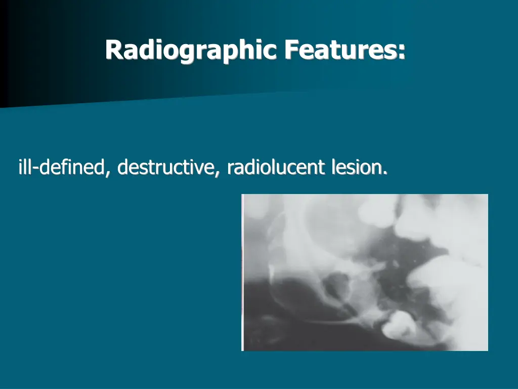 radiographic features