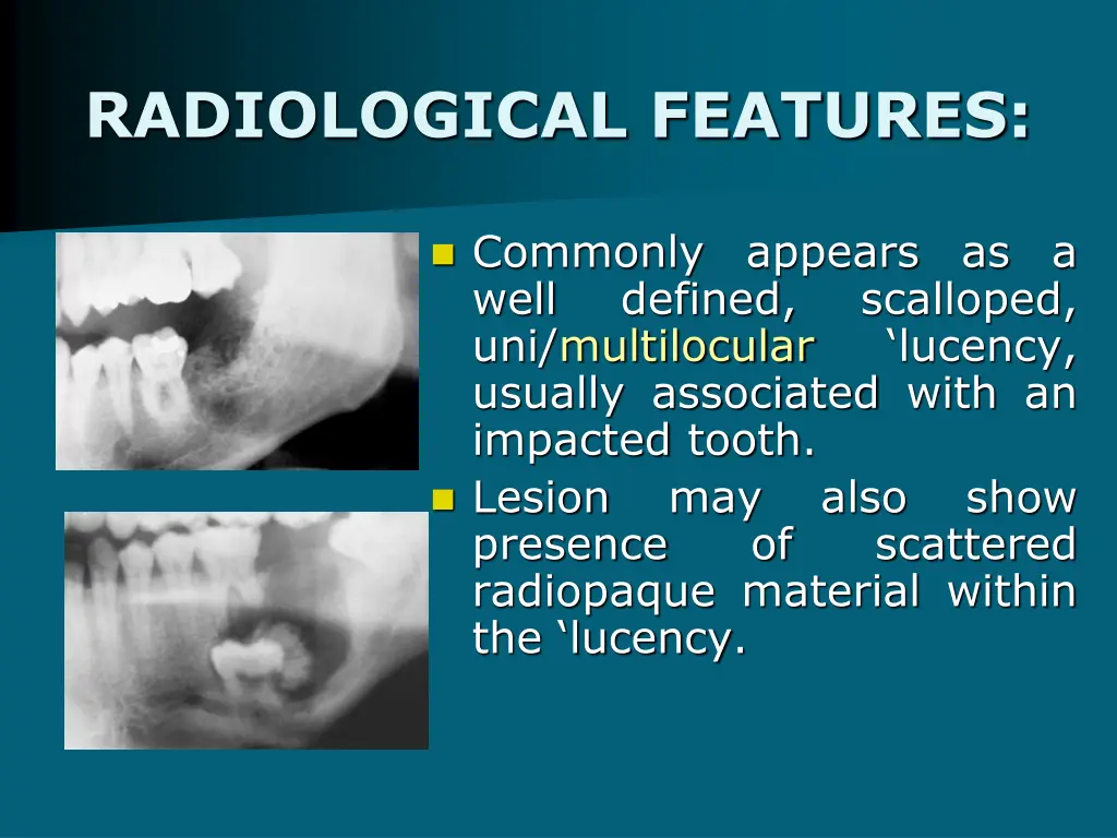 radiological features 1