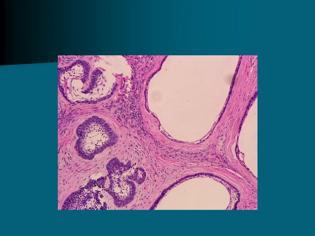 slide2