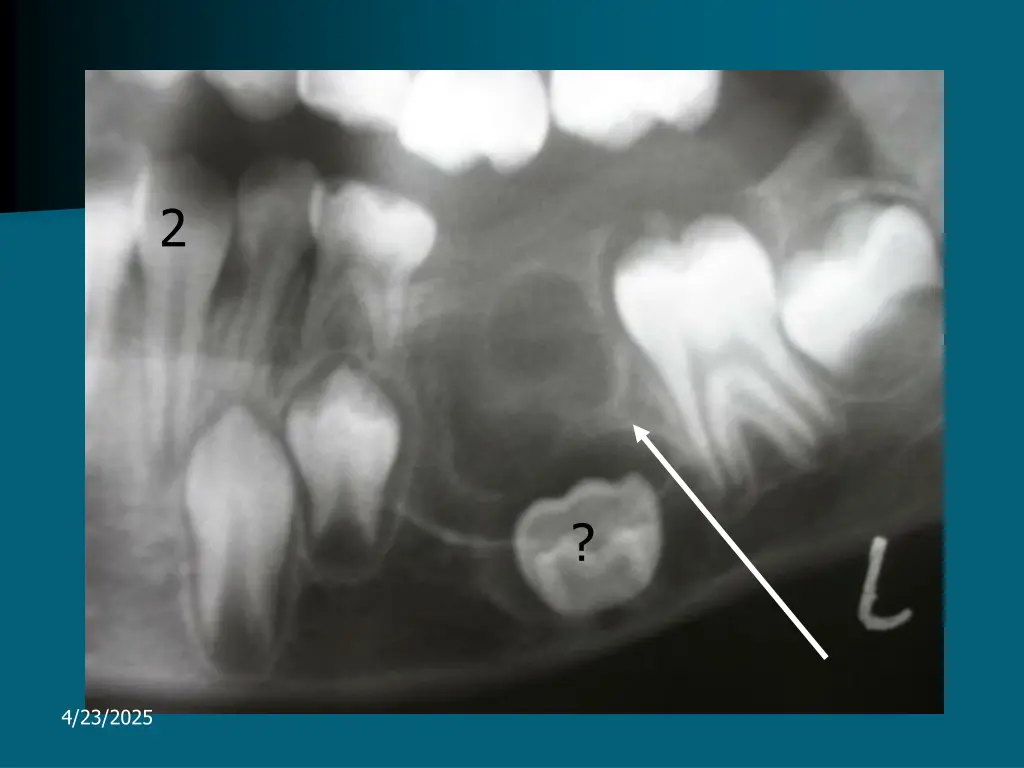 slide31