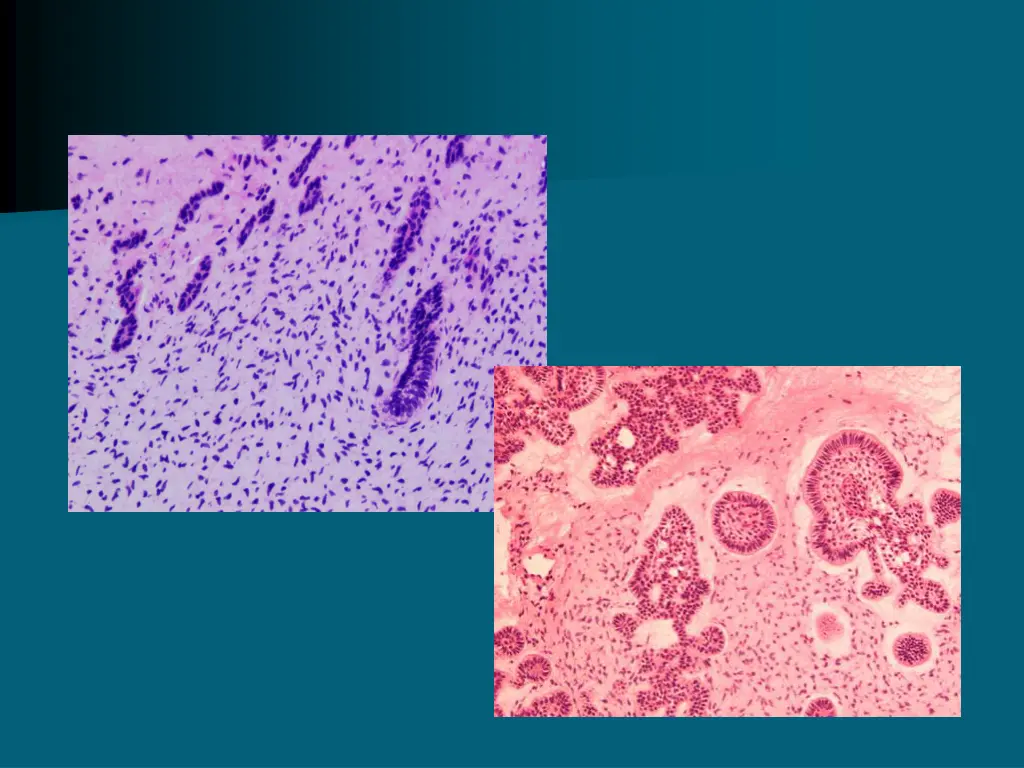 slide34