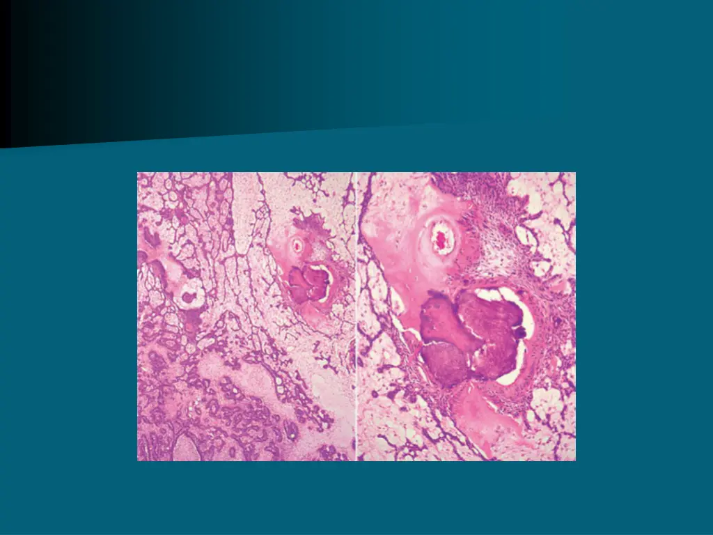 slide39