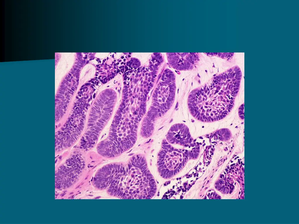 slide4