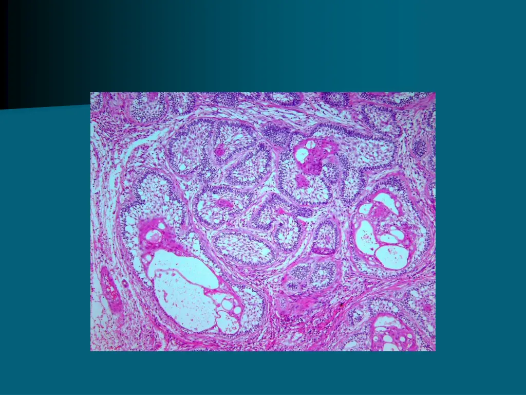 slide6