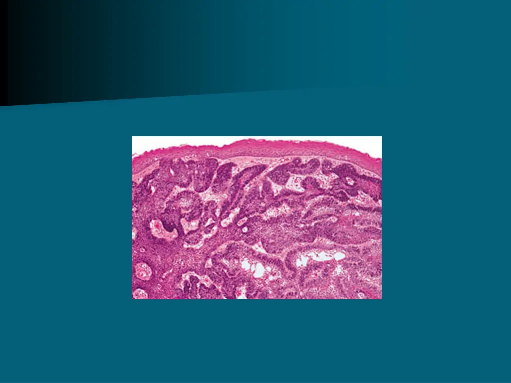 slide8