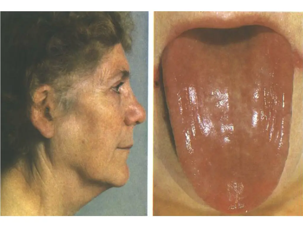 slide13