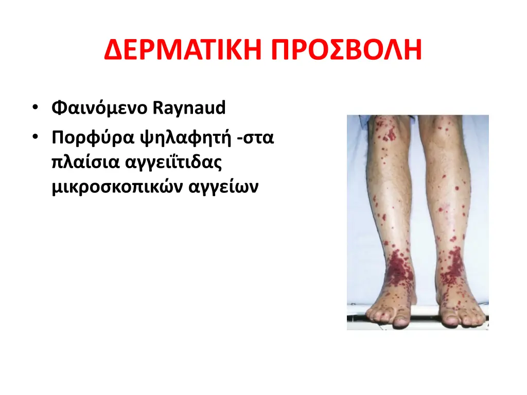 slide18
