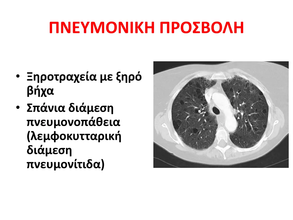 slide19