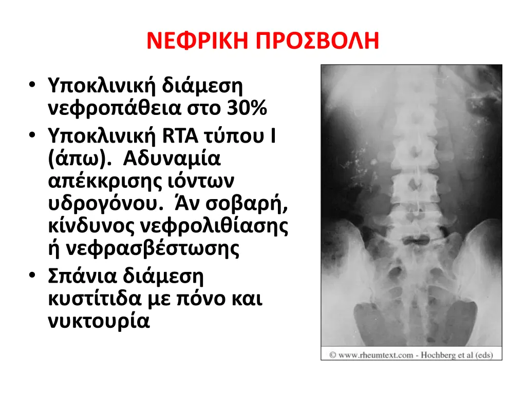 slide21