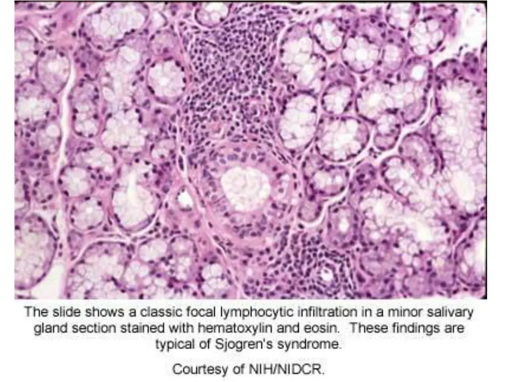 slide27