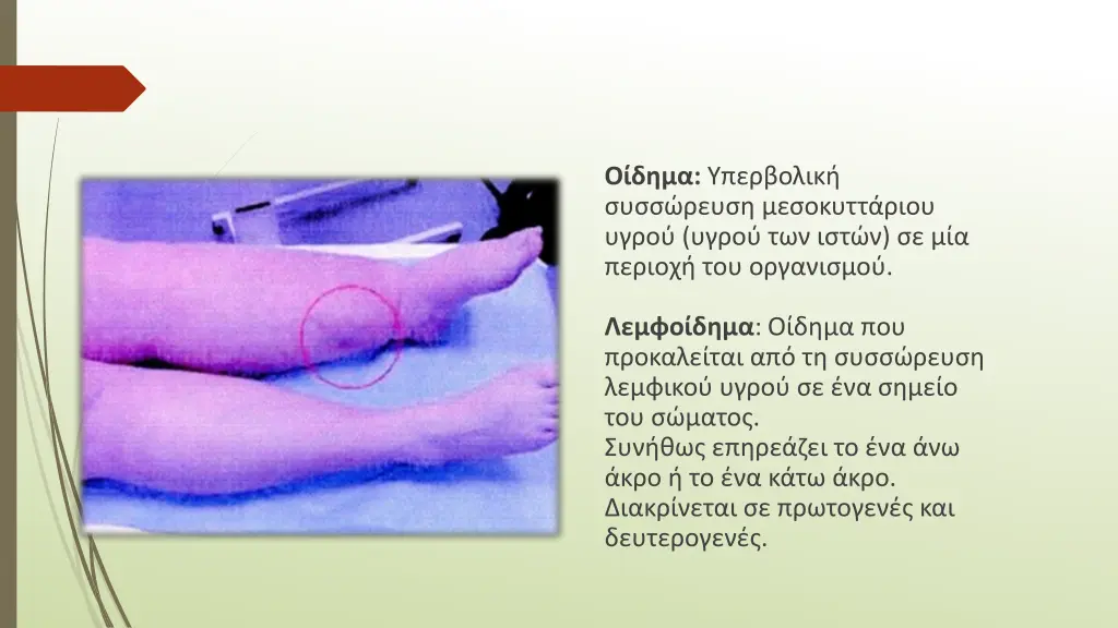 slide13