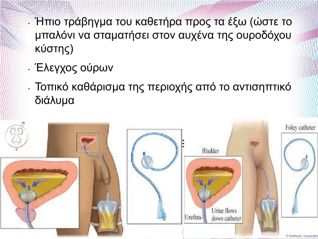 slide11
